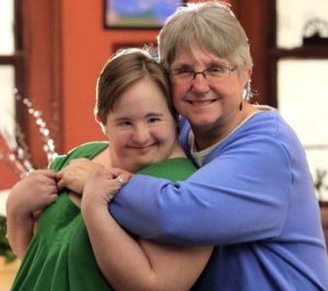 Do down syndrome adults develop alzheimers